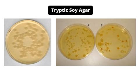 Tryptic Soy Agar (TSA) - Composition, Principle, Preparation, Results ...