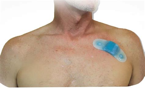 Band-Aid like patch that records 7 times more than a typical Holter Monitor. | Holter monitor ...