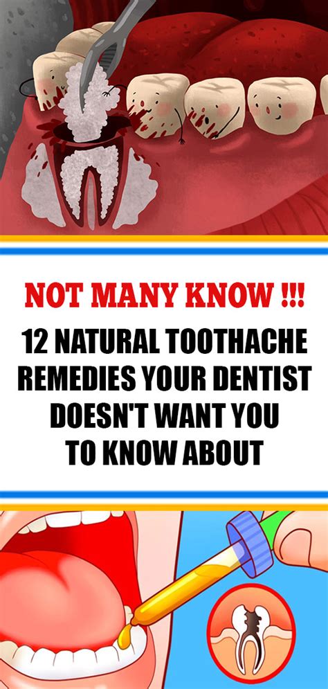 12 Natural Toothache Remedies Your Dentist Doesn’t Want You to Know ...