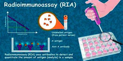 Radioimmunoassay - an Immunological Assay - Assignment Point