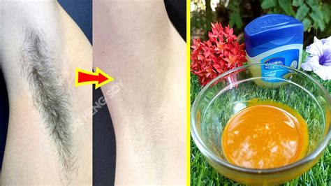 Remove Unwanted Armpit Hair Naturally Permanently | 100% Works At Home - YouTube