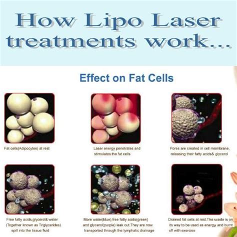 Pin by New Life Wellness at Corfman C on medical aesthetics | Laser ...