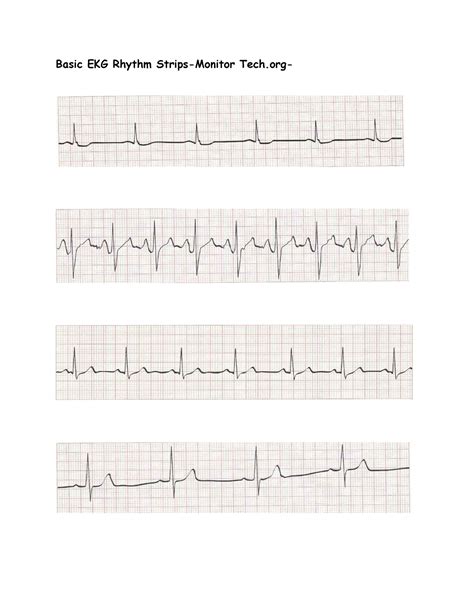 EKG Practice Strips - MS1 - Basic EKG Rhythm Strips-Monitor Tech- - Studocu