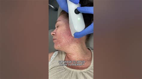 Sofwave Vs. Ultherapy: Which one is Right for me? | DR. MEDISPA - YouTube