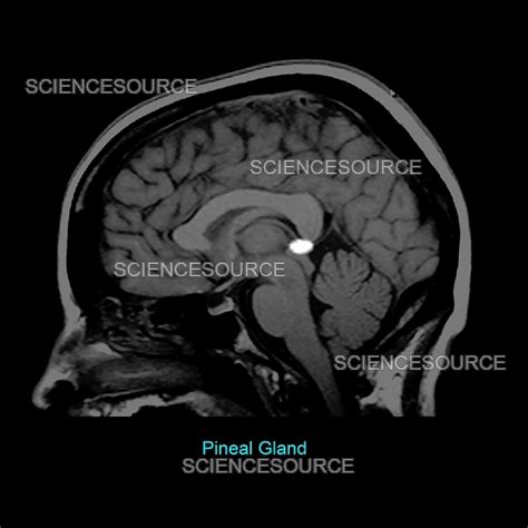 Brain Pineal Gland