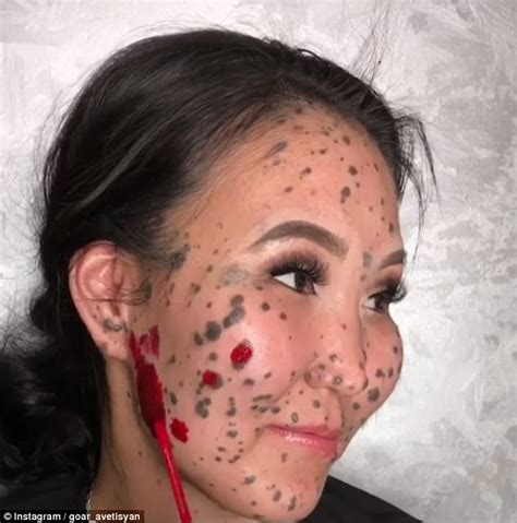 Woman born with moles on her face reveals transformation | Daily Mail ...