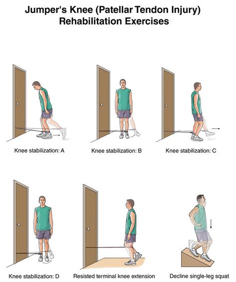 Patellar Tendinitis - Causes, Symptoms, Stretching, Exercises, Treatments