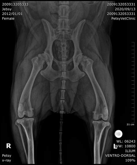 Femoral head and neck ostectomy (FHO) after bilateral CHD and hip ...