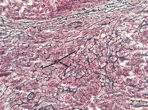 Reticular Connective Tissue 20x | Histology