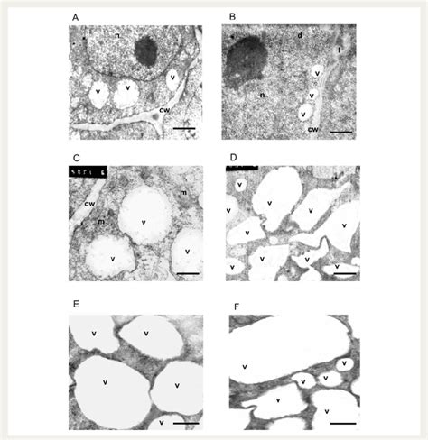 Electron micrographs of hypocotyl (A, C, E, F) and radicle (B, D) cells ...