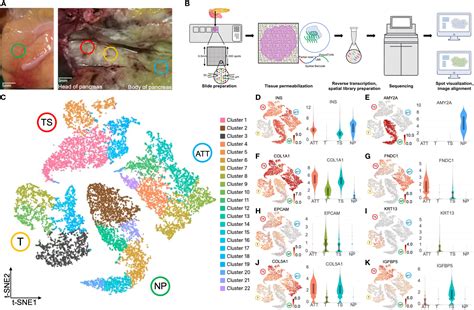 Frontiers | Spatial transcriptomics reveals the heterogeneity and FGG ...