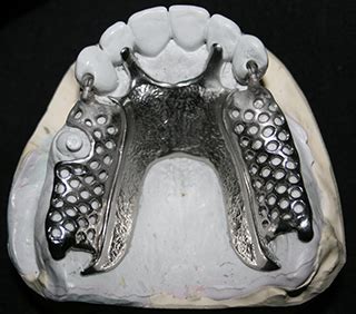 Collis Prosthodontic Laboratory