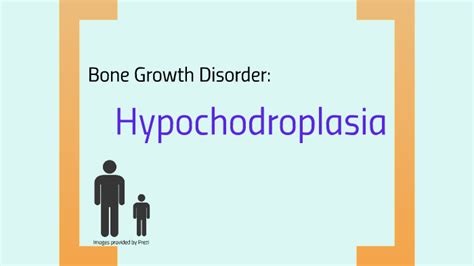 Hypochondroplasia by minsu park on Prezi