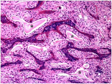 Osteitis fibrosa cystica in a domestic young cat