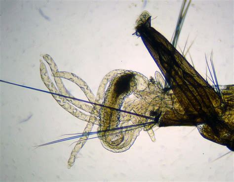 Anatomy of a mosquito larva. From top to bottom:...