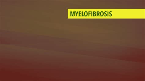 Treatment of Myelofibrosis - CancerConnect