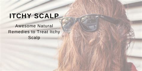 Awesome Natural Remedies To Treat Itchy Scalp – TGDaily