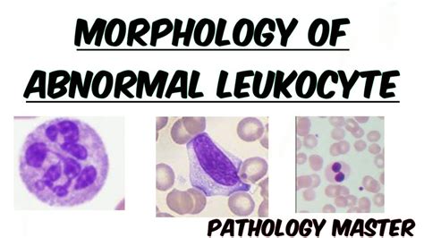 Abnormal Leukocyte Morphology | In Peripheral Blood Smear | Images ...