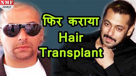 क्या शादी के लिए Salman Khan ने फिर कराया हैं Hair Transplant ? - YouTube