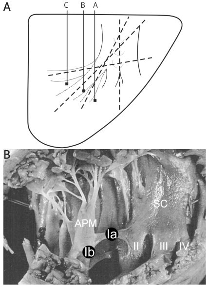 A – The angles of branching of the septomarginal trabecula from the... | Download Scientific Diagram