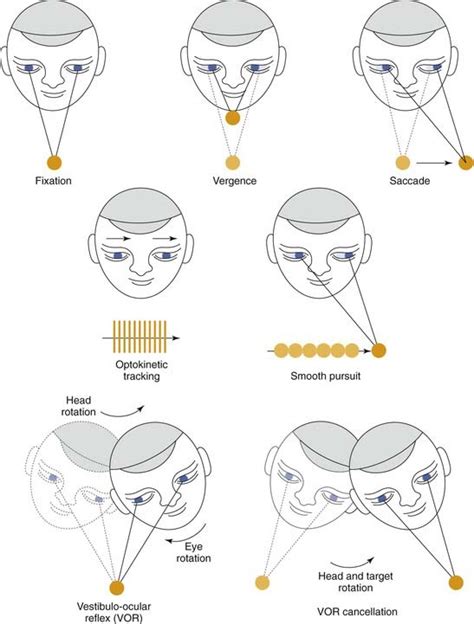 Evaluation of the Patient with Dizziness | Ento Key