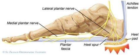 Heel Fat Pad Syndrome: Symptoms, Causes Treatment | atelier-yuwa.ciao.jp