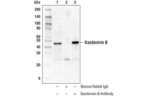 Gasdermin Family Antibody Sampler Kit | Cell Signaling Technology