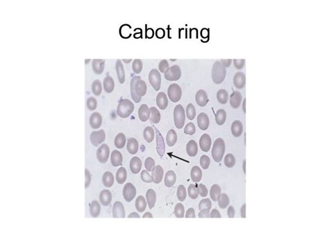 Peripheral smear