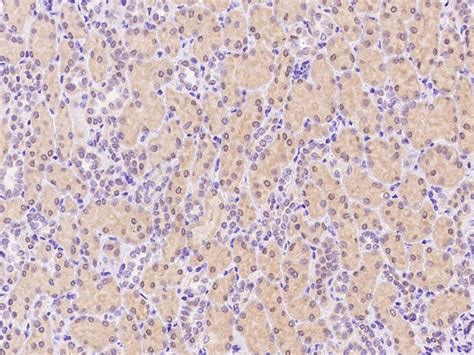 IFN gamma Antibody Guideline: Preparation, Dilution and Applications ...