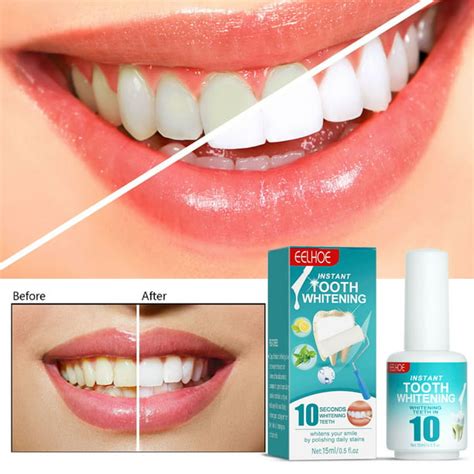 Tooth Paint, Tooth Polish Uptight White, Instant Whitening Paint for ...