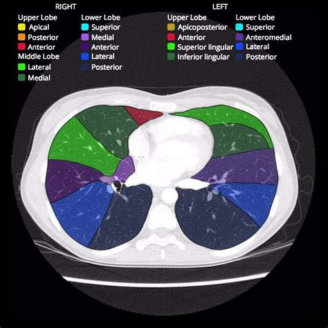 Lung Segments