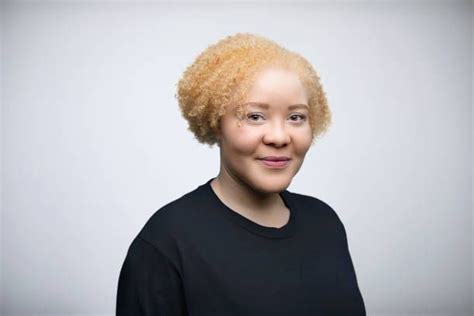 Albino Celebrities Who Inspire Us – African Celebs