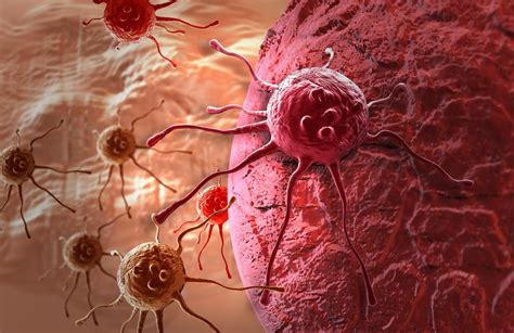 The role of bacteria in cancer growth | MedMDS