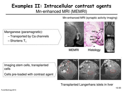 PPT - 12: MRI contrast mechanisms PowerPoint Presentation, free download - ID:4901597