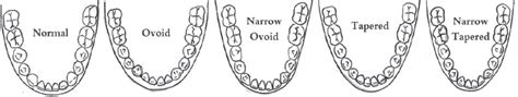 Dental arch dimensions, form and tooth size ratio among a Saudi sample ...