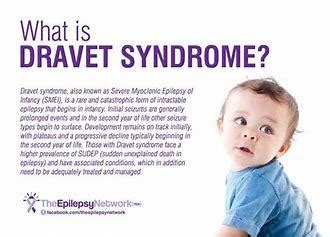 Zogenix's Medication For Dravet Syndrome Likely Delayed 12-15 Months - Zogenix, Inc. (NASDAQ ...