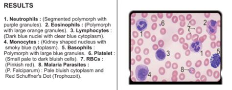 Wright S Stain Procedure Principle And Results - vrogue.co