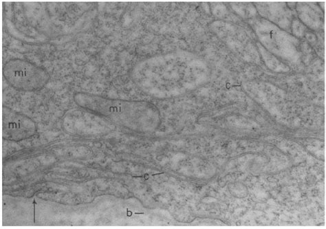 Same as Fig. 3. The arrow points to an infolding of the plasma membrane... | Download Scientific ...