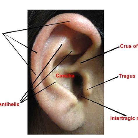 Anatomical landmarks of Human Ear. | Download Scientific Diagram