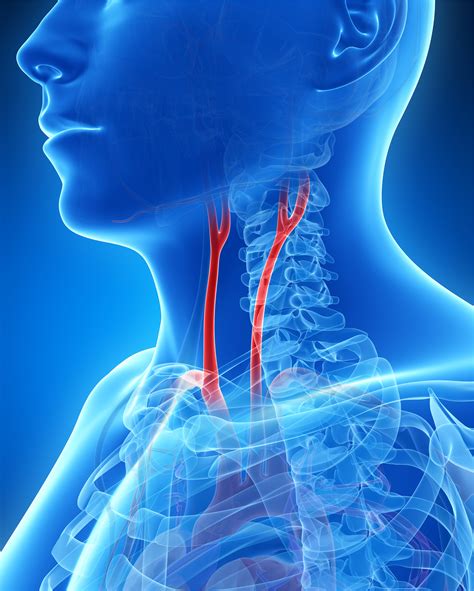 carotid endarterectomy - ctvsurgeons