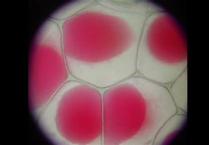 Plasmolysis : Various Types Of Plasmolysis In Plants With Detailed ...