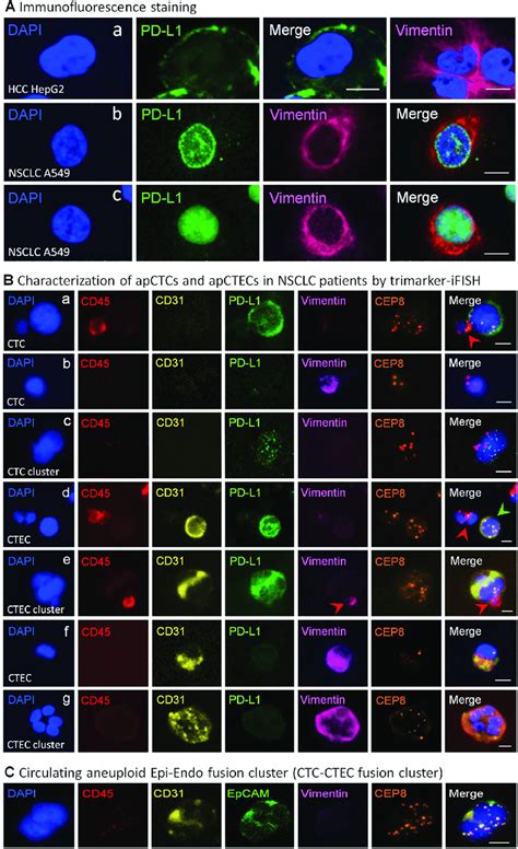 In situ co-detection of diverse subtypes of aneuploid CTCs and CTECs... | Download Scientific ...