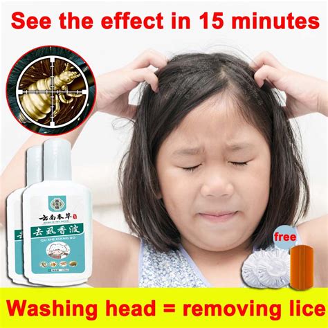 anti lice shampoo for kids lice removal shampoo 120ml Kills hair lice, larvae, and lice eggs ...