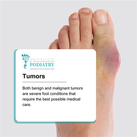 Benign and Malignant Tumors - Premier Podiatry: Velimir Petkov, DPM ...