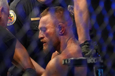 Conor McGregor reveals extent of horrific leg injury