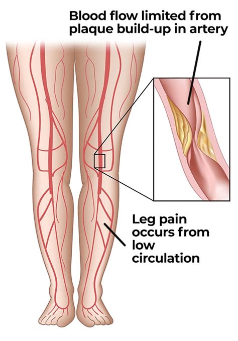 fumaça Por que não Prestar atenção em blood circulation in legs ponto ...