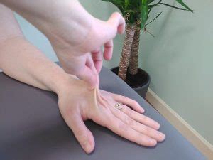 What is hypermobility? Signs and symptoms of HSD and EDS-HT - College ...