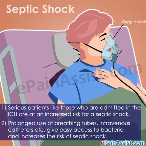 Bacteria Clipart Sepsis Picture Bacteria Clipart Sepsis | My XXX Hot Girl