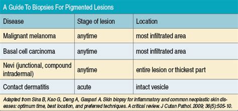 When Should You Biopsy?