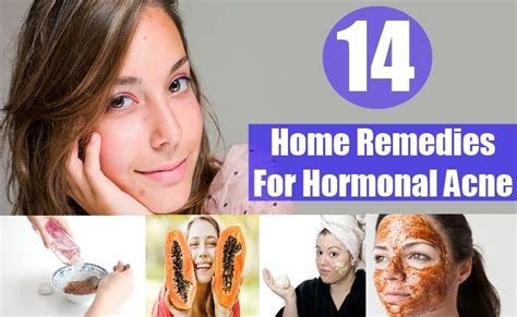 14 home remedies for hormonal acne | Hormonal acne, Natural acne ...